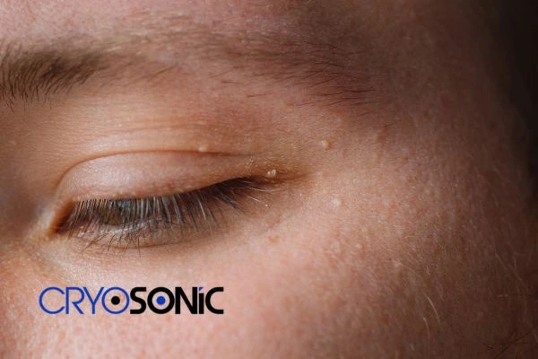 Why Is Professional Care Better Than Home Remedies Blackpool