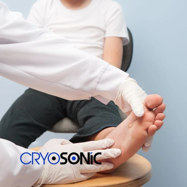 Are you looking for fast effective wart removal Contact us today Blackpool